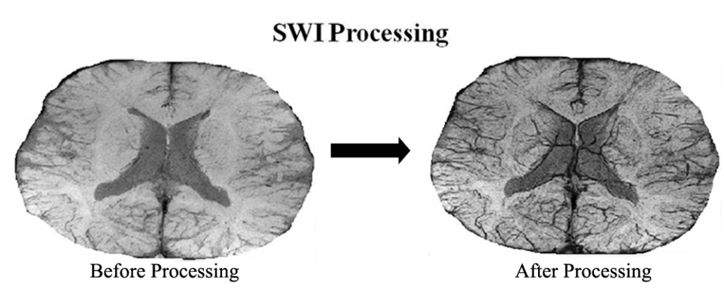 By leveraging deep learning algorithms and vast amounts of data, generative AI models can generate realistic images, enhance existing images, and even predict disease progression. Source: StatusNeo 